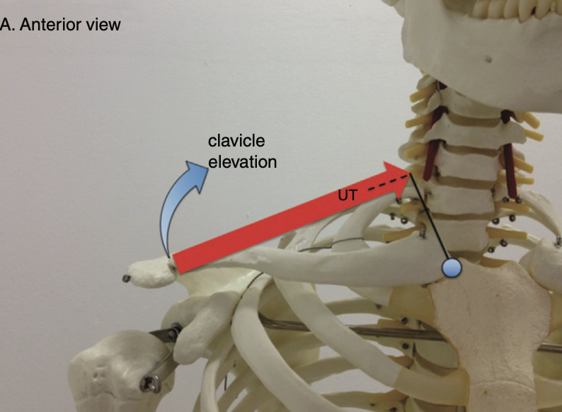 上部僧帽筋による鎖骨の挙上と後退作用を示す生体力学モデル図