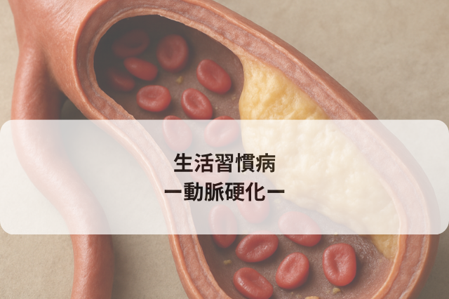 生活習慣病　−動脈硬化−