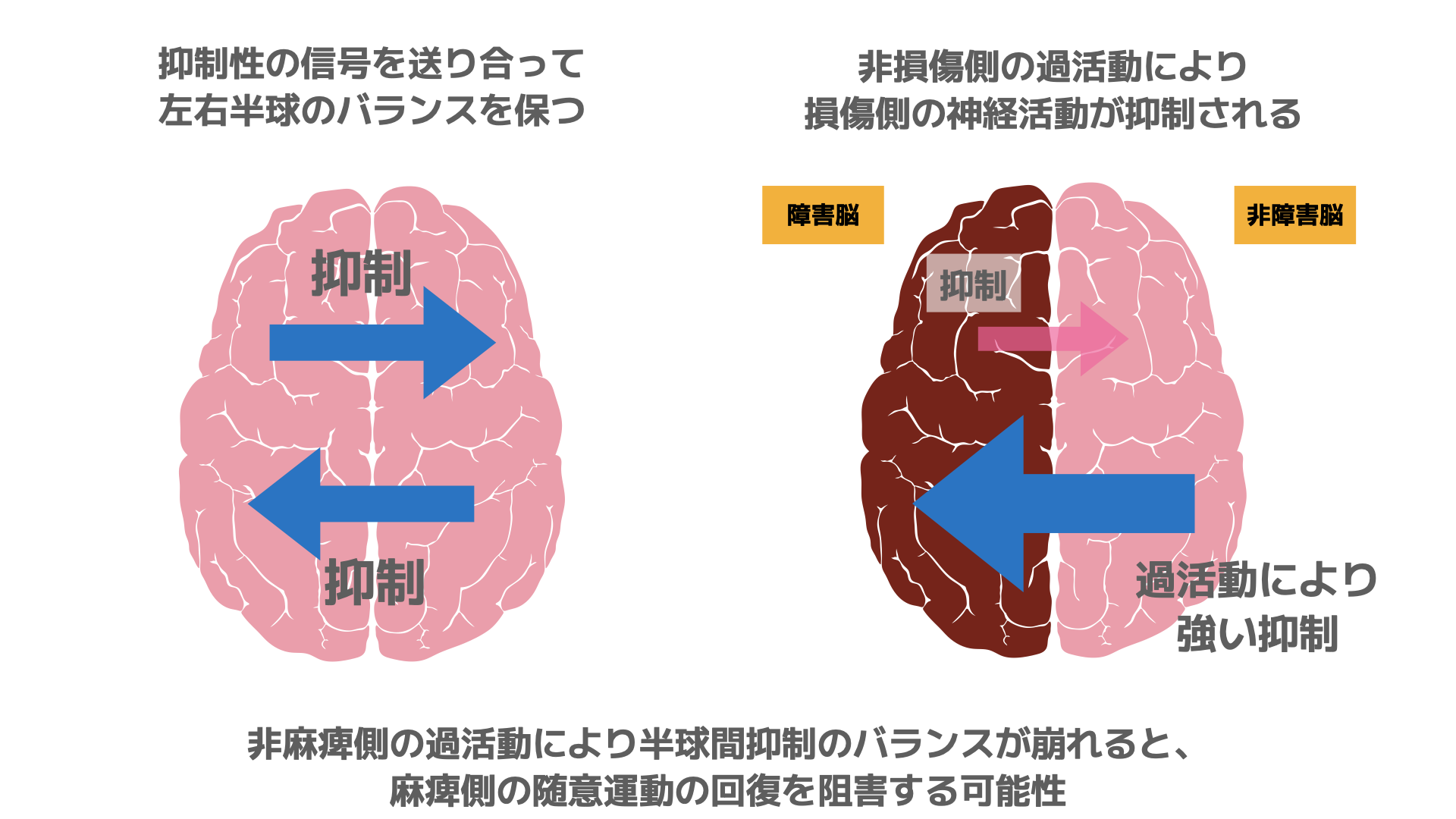 半球間抑制のイメージ図